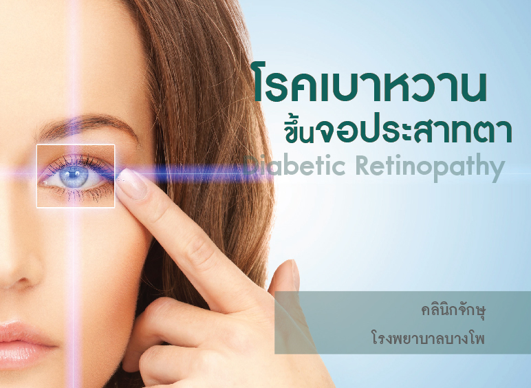 เบาหวานขึ้นตา – โรงพยาบาลบางโพ