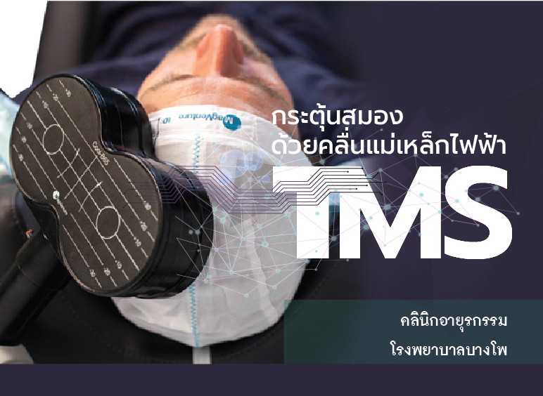 กระตุ้นสมองด้วยคลื่นแม่เหล็กไฟฟ้า (TMS) – โรงพยาบาลบางโพ